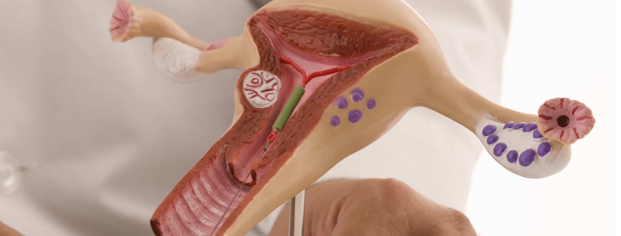 'ABC' del prolapso uterino