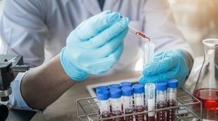 Sida: Mitos y leyendas sobre esta enfermedad